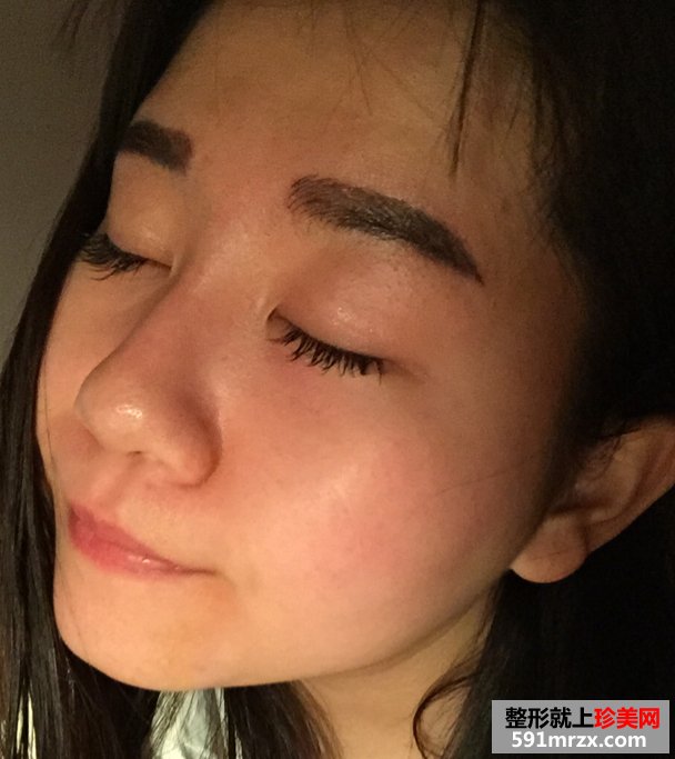 北京韩式半永久纹眉毛的成功案例有前后对比效果图片和恢复过程